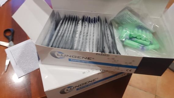 Covid19, il Comune di Calvi acquista 500 kit rapidi per l’identificazione degli anticorpi anti coronavirus